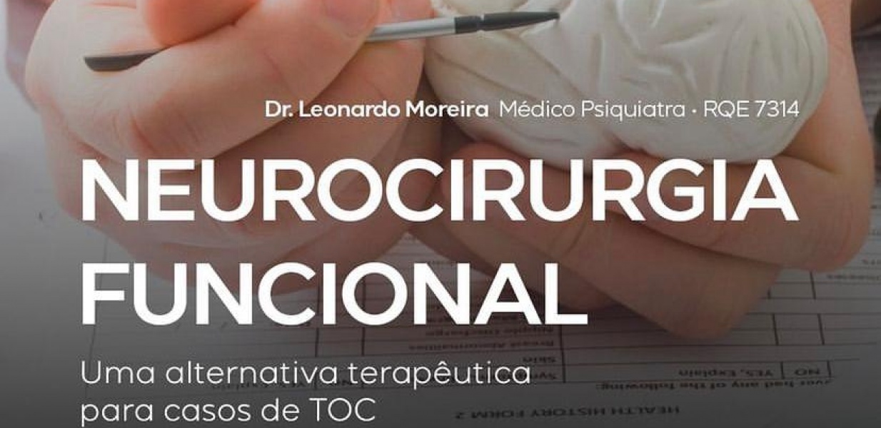 Neurocirurgia funcional - Uma alternativa terapêutica para os casos de TOC