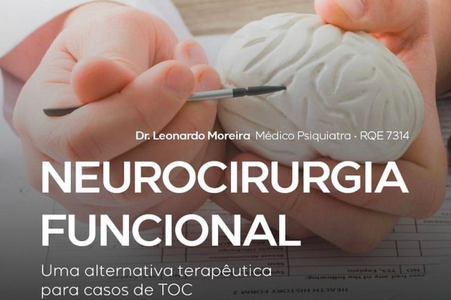 Neurocirurgia funcional - Uma alternativa terapêutica para os casos de TOC