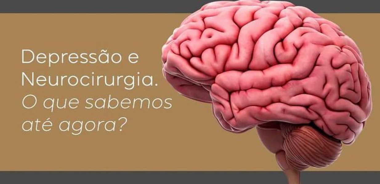 Depressão e neurocirurgia - O que sabemos até agora?