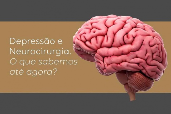 Depressão e neurocirurgia - O que sabemos até agora?