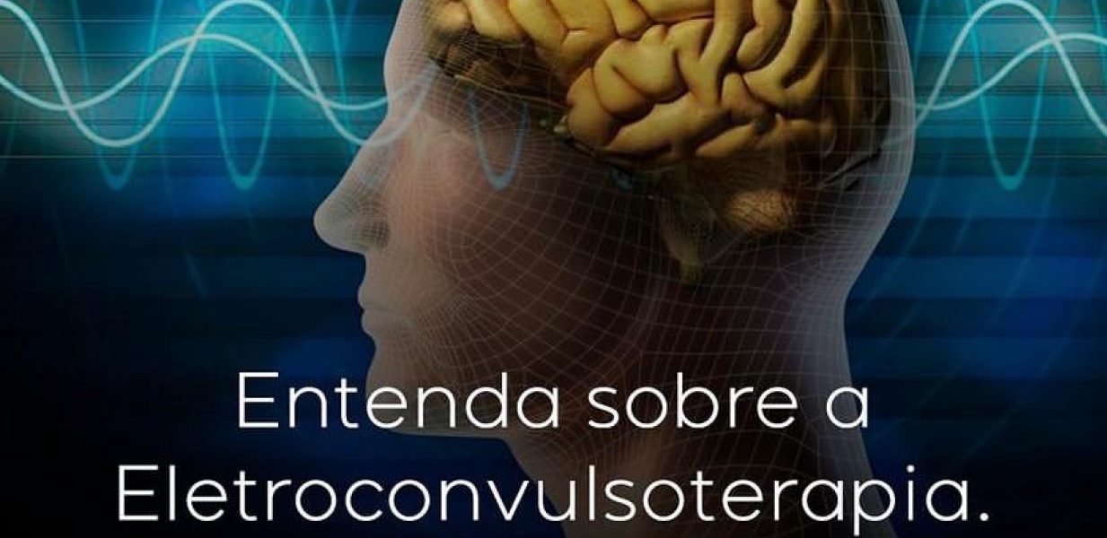 Entenda sobre a eletroconvulsoterpia