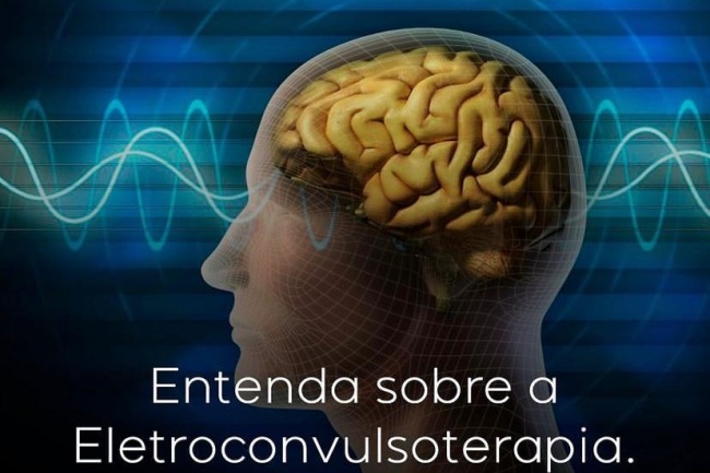 Entenda sobre a eletroconvulsoterpia